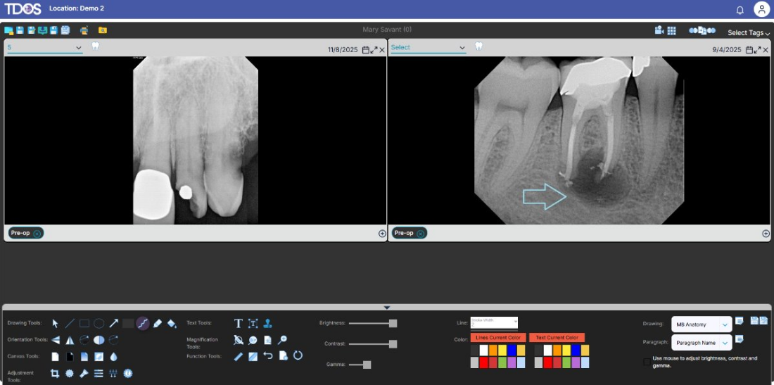 TDOS image viewer with side-by-side endodontic radiographs and annotation tools